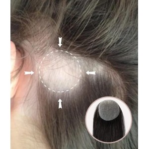 Full Skin Base Cover Up Hair Patches Pieces No Surgical Solution For Alopecia Areata Full Skin Base Cover Up Hair Patches Pieces No Surgical Solution For Alopecia Areata