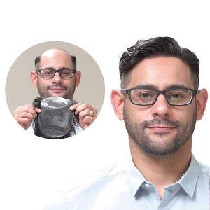 0.08mm Natural Skin Hairpiece Replacement For Men 0.08mm Natural Skin Hairpiece Replacement For Men